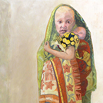 Albinomeisje met zusje